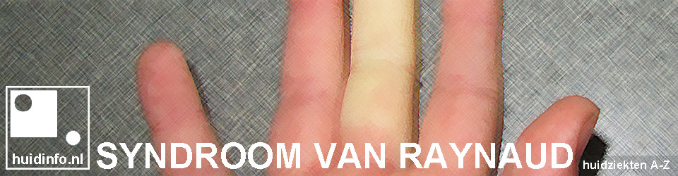 syndroom van raynaud