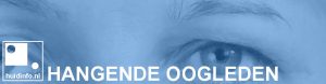 hangende oogleden ptosis