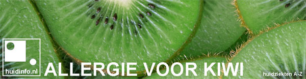 allergie voor kiwi