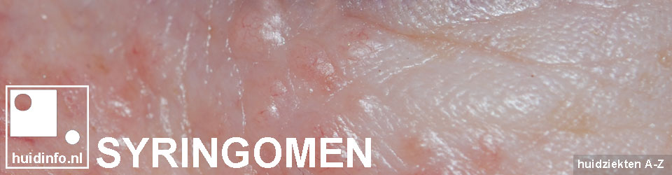 syringomen oogleden