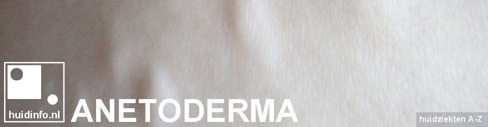 Anetoderma