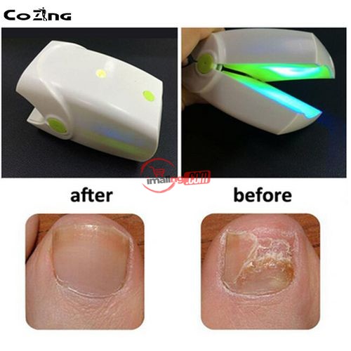 Cozing Infrared Cold Laser Nail Fungus Therapy Device Toe And Finger Nail Fungus Laser Treatment Machine