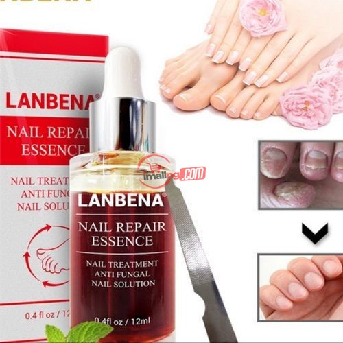 Lanbena Nail Repair Essence Anti Fungus Treatment Oil 12ml