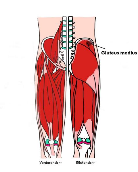 Illustration der Triggerpunkte des Gluteus medius