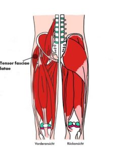 Illustration der Triggerpunkte des Tensor faciae latae