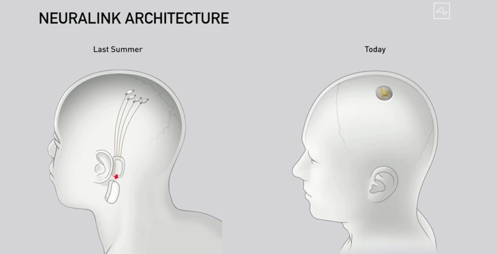 Neuralink