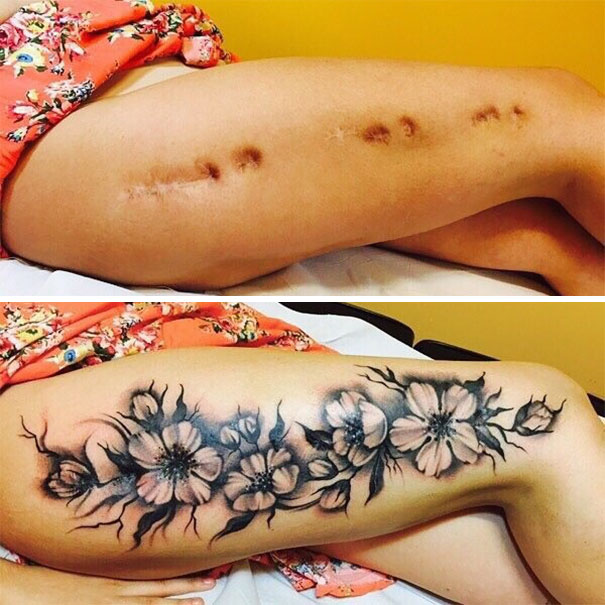 Tatovering over arr og strekkmerker 2 scars-tattoo-cover-up-46-590b24604a6a5__605