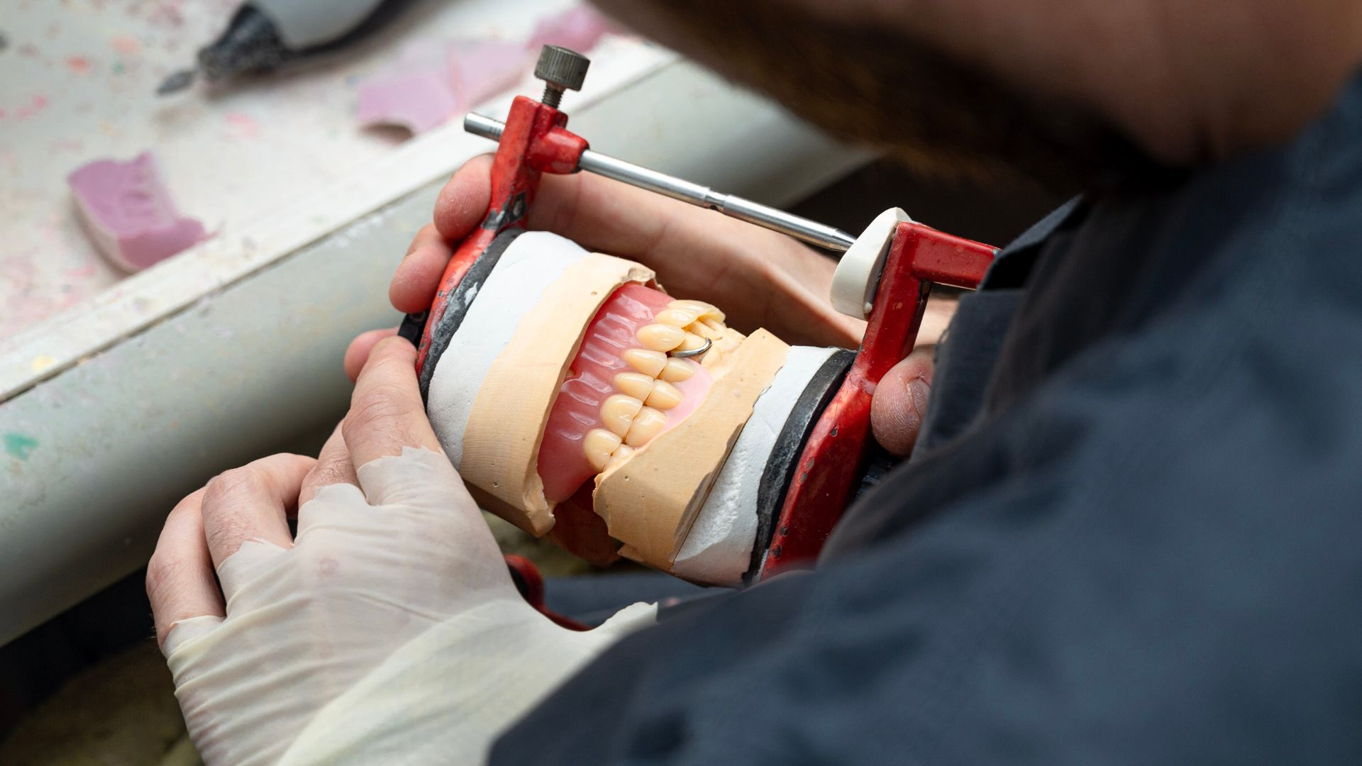 Fabrication prothèses dentaire