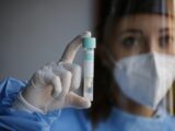 Covid, 4.021 nuovi casi 72 decessi e tasso positività a 1,26%