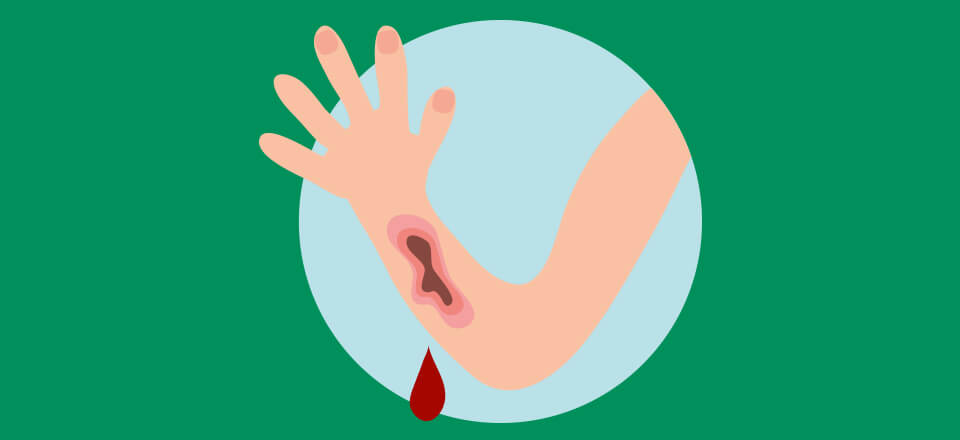 Jyllinge-Fysioterapi-Træning