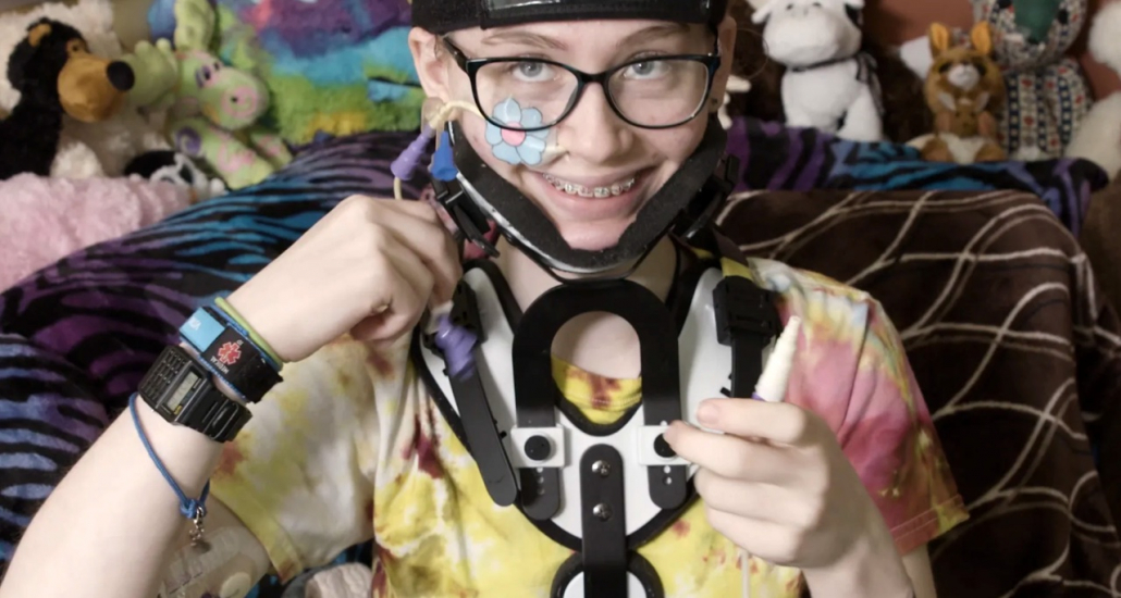 The picture shows a person smiling at the camera, wearing a tie-dye shirt with yellow, pink, and blue colors. They have short hair, glasses, and a black neck brace with white trim. On their face, there is a small flower-shaped patch on their right cheek. They are holding up a feeding tube. Behind them is a background of various stuffed animals.