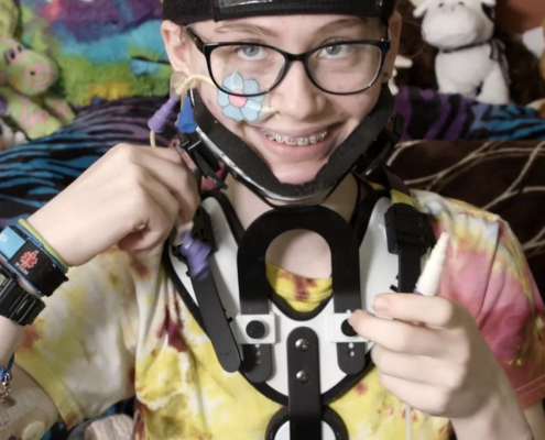 The picture shows a person smiling at the camera, wearing a tie-dye shirt with yellow, pink, and blue colors. They have short hair, glasses, and a black neck brace with white trim. On their face, there is a small flower-shaped patch on their right cheek. They are holding up a feeding tube. Behind them is a background of various stuffed animals.