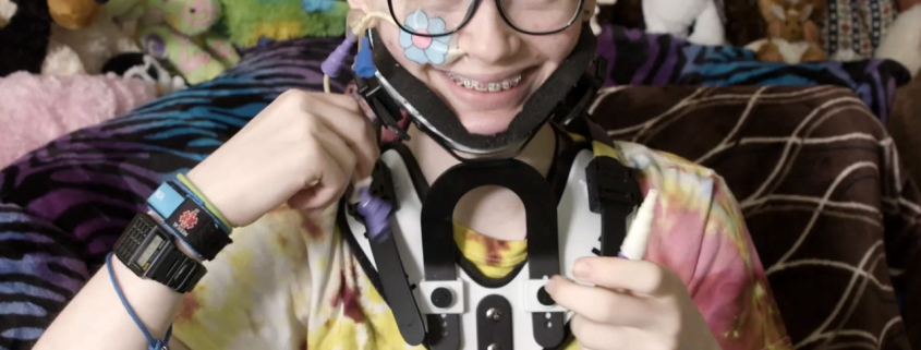 The picture shows a person smiling at the camera, wearing a tie-dye shirt with yellow, pink, and blue colors. They have short hair, glasses, and a black neck brace with white trim. On their face, there is a small flower-shaped patch on their right cheek. They are holding up a feeding tube. Behind them is a background of various stuffed animals.