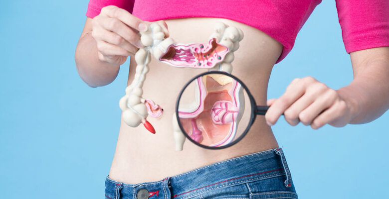 سرطان الأمعاء