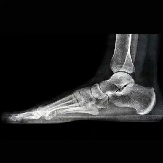 Rehab – Fot