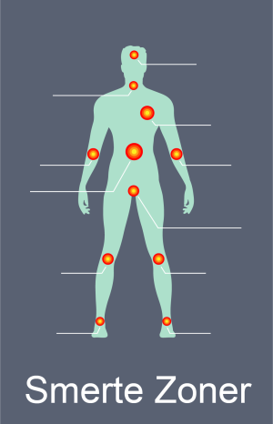 Smerte zoner på kroppen