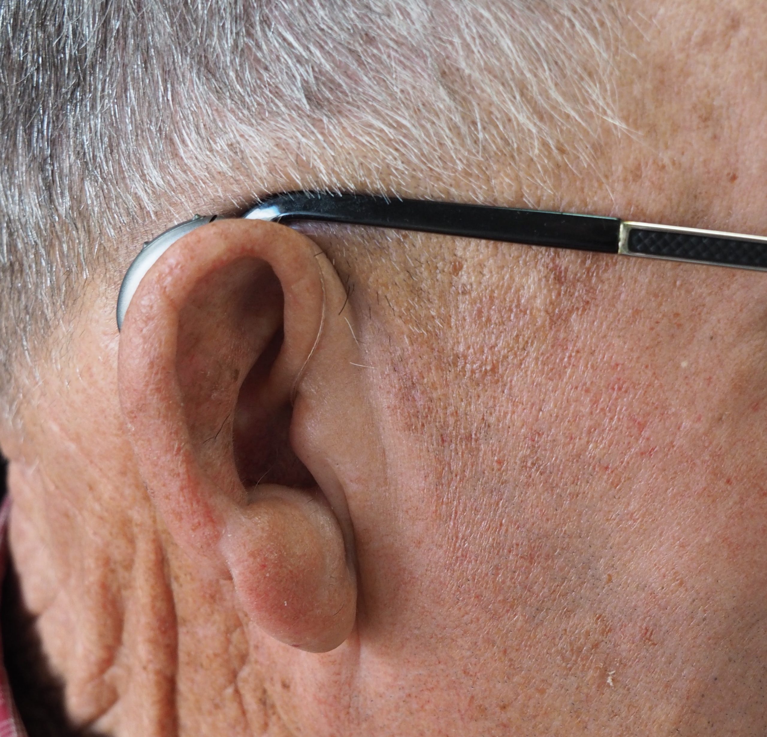 Hvordan får man et høreapparat? – Læger Formidler