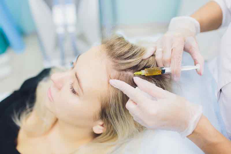 PRP behandling håravfall