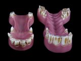 Zebra Jaw with Front Teeth to Second Molar