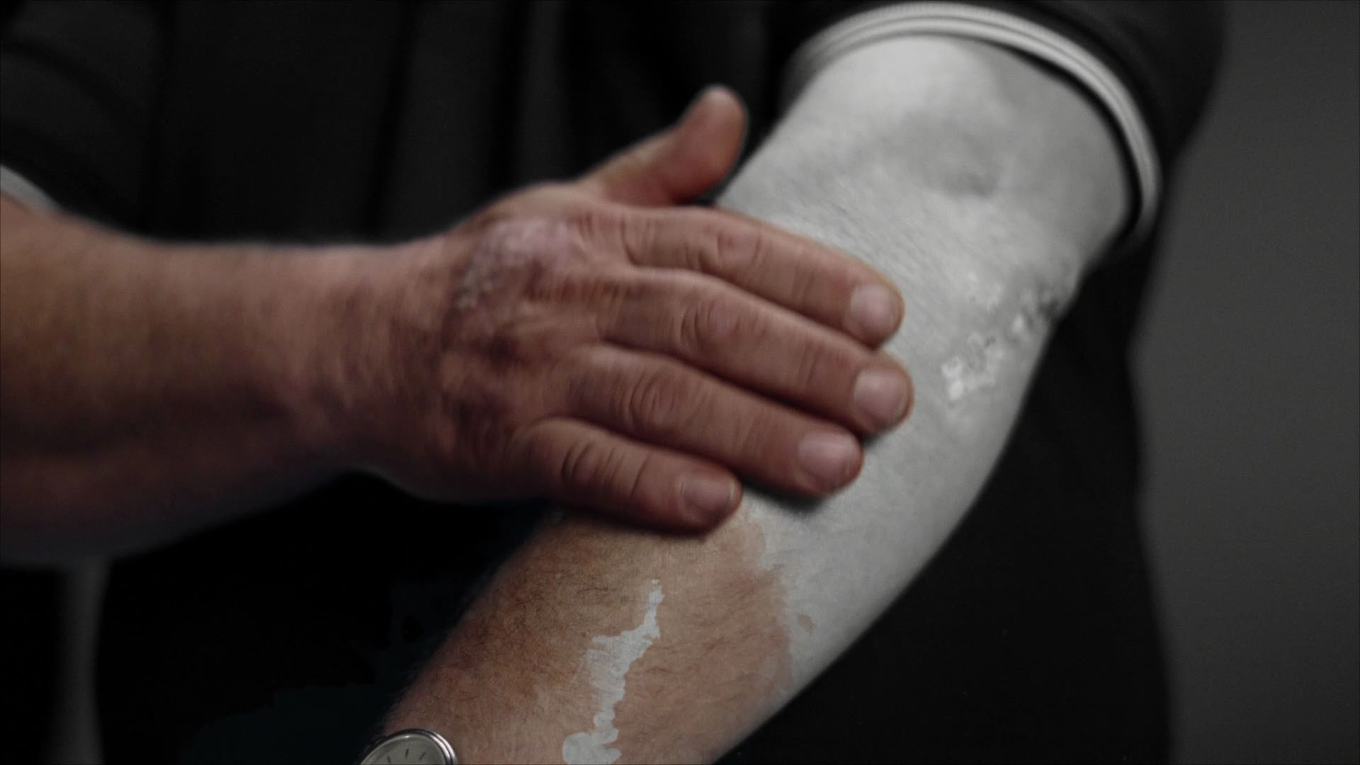 Psoriasisforening screengrab 9
