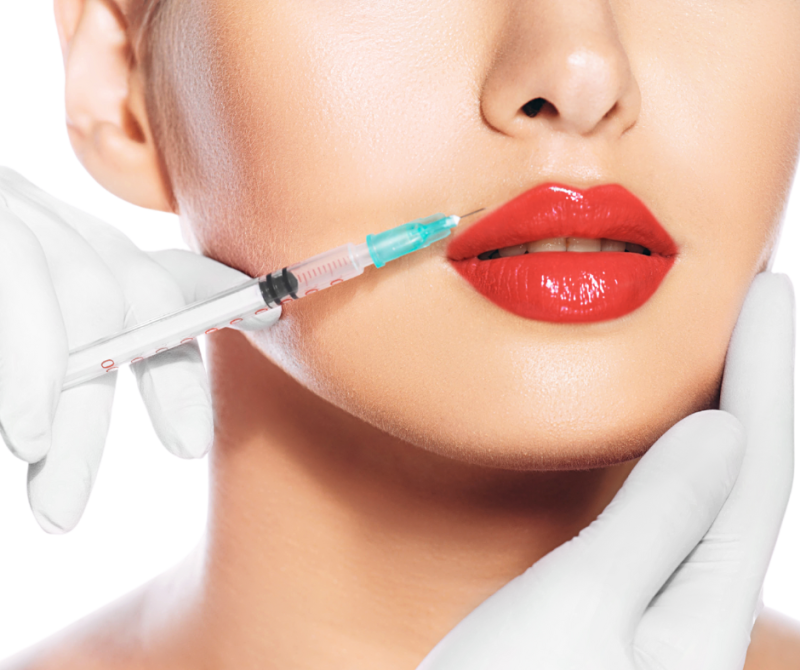 LipFiller (1)