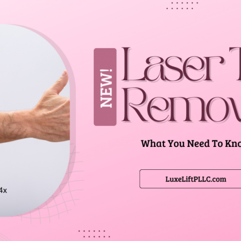 The Complete Guide to Laser Tattoo Removal: What You Need to Know