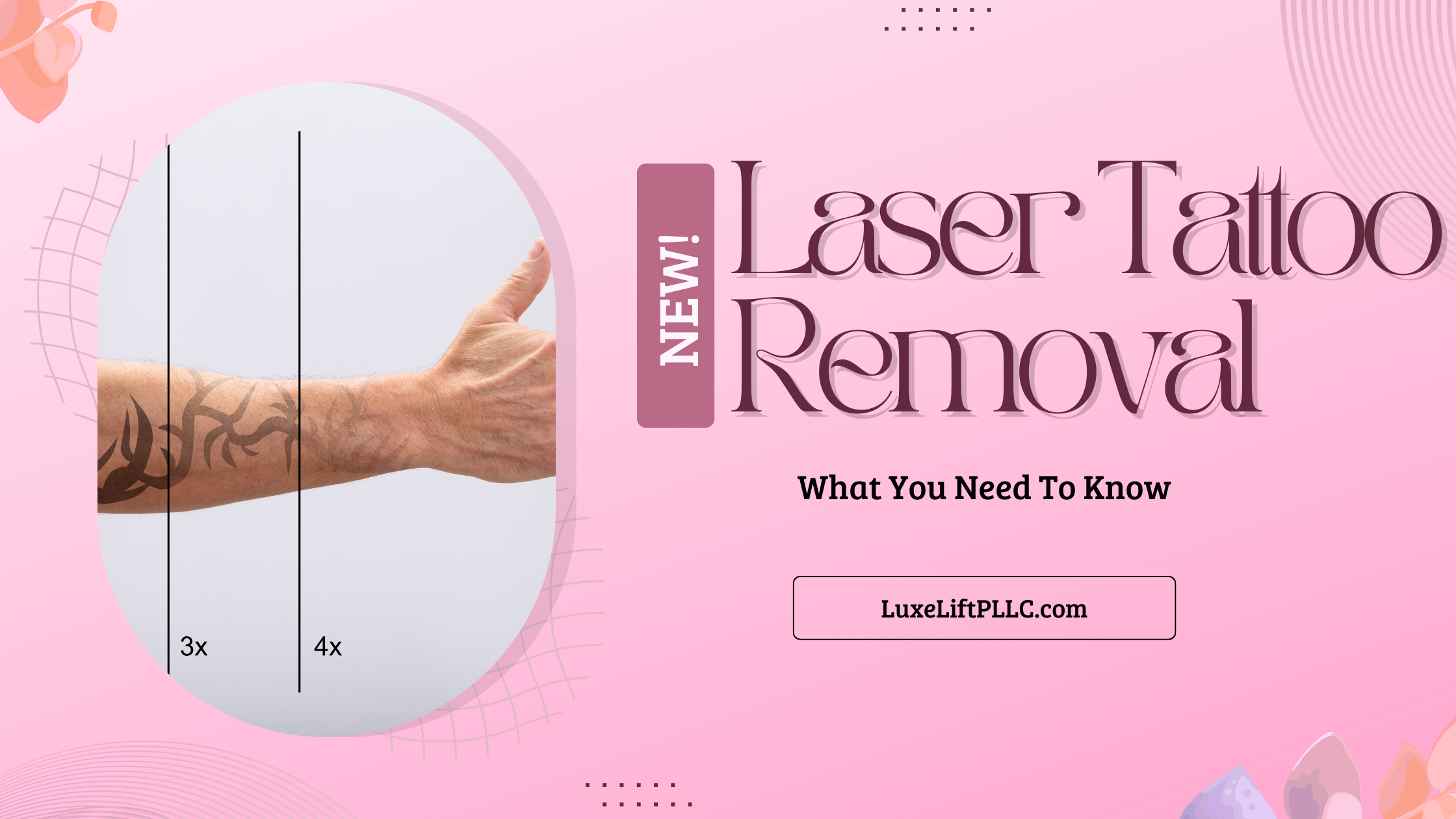 The Complete Guide to Laser Tattoo Removal: What You Need to Know