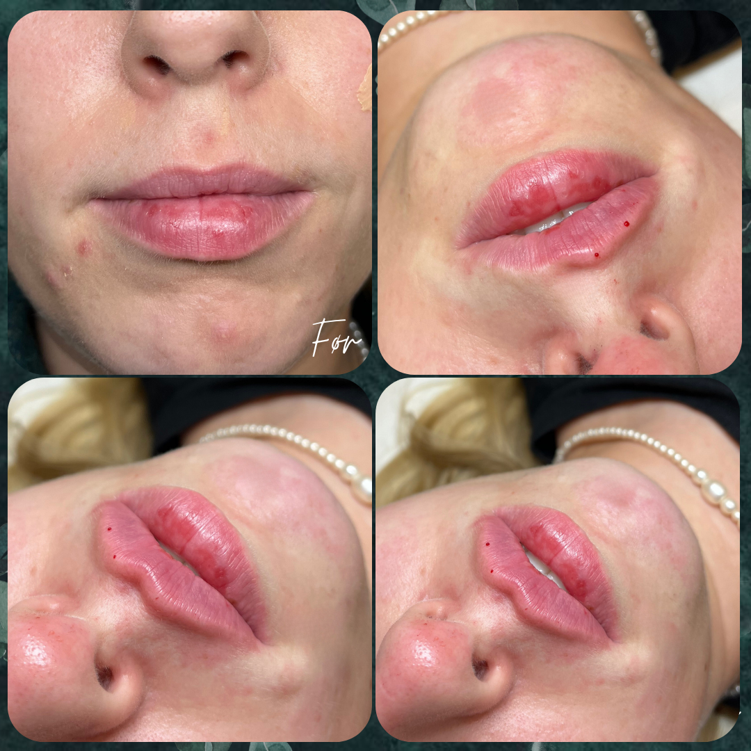 Russian lips