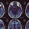 brain scans