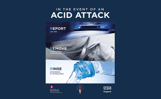 Acid Attack Guidance From SIA