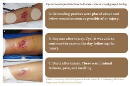 Cyclist injured in Tour de France, wound healing fast with grounding patches.