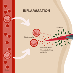 inflammatory response with free radicals