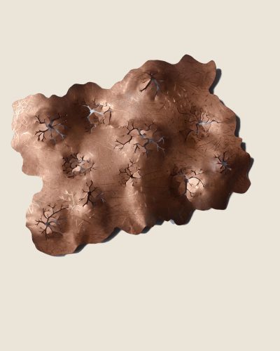 Ursula Hähner, Injuries, body-related object, 2024/2025