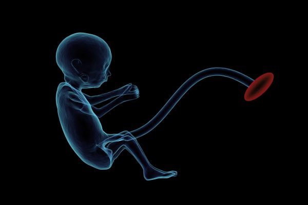 New study focuses on the placenta for clues to the development of gestational diabetes