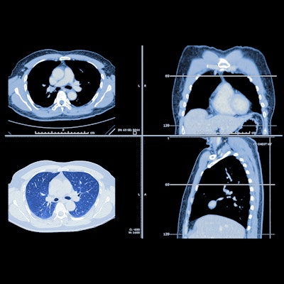 Blackford, Thirona partner for lung imaging analysis Blackford, Thirona partner for lung imaging analysis
