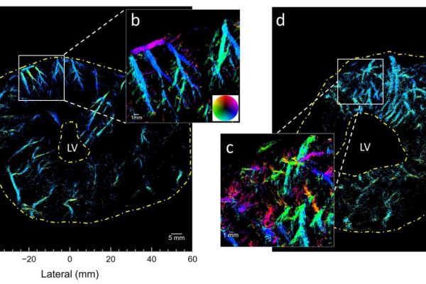 Microscopic heart vessels imaged in super-resolution for the ﬁrst time