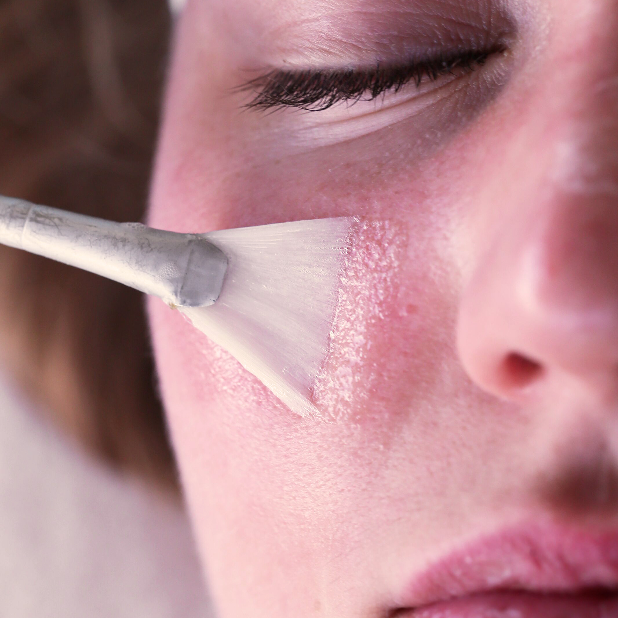 Kvinne som ligger på behandlingsbenk og blir smurt inn med kjemisk peeling i ansiktet ved hjelpe av en viftebørste