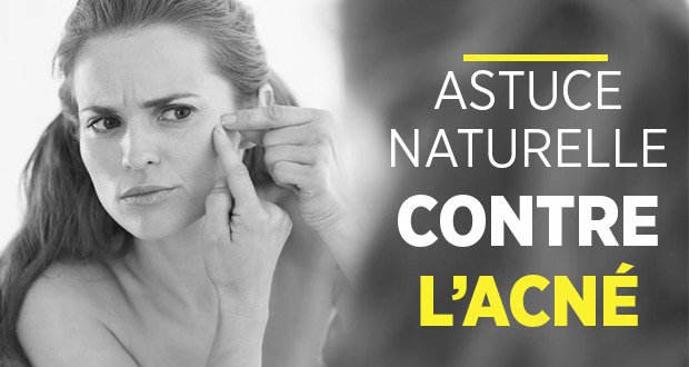 Astuce naturelle contre l’acné