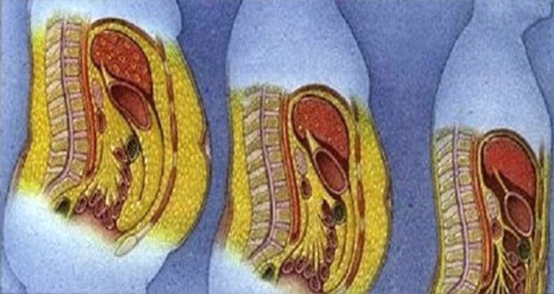 La recette des nutritionnistes pour perdre la graisse abdominale rapidement