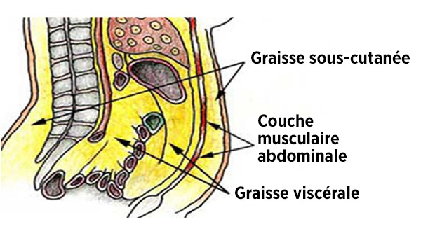 Comment se débarrasser de la graisse abdominale, ce tueur silencieux