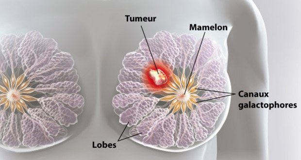 Nous en buvons tous les jours mais nous ignorons qu’il est en grande partie responsable du cancer du sein…