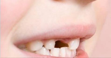 Les dentistes mettent en garde: ne jetez pas les dents de lait! Cela peut sauver la vie de votre enfant!