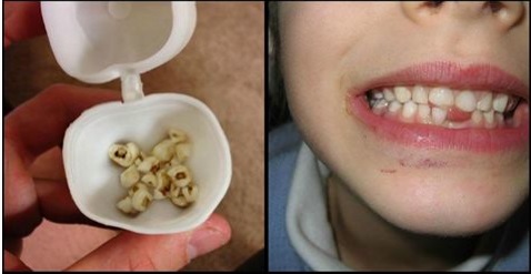 Les docteurs supplient les parents de garder les dents de bébé de leur enfant!