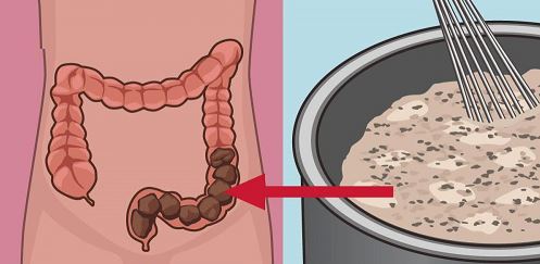 Nettoyez votre colon des déchets toxiques grâce à ce remède maison !