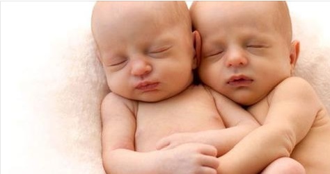 Un bébé embrasse sa jumelle qui était en train de mourir: Ce qui est arrivé a choqué le monde entier