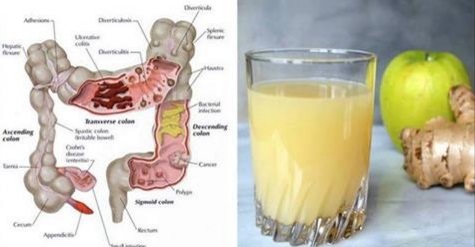 Le jus de nettoyage du côlon à 3 ingrédients : Comment les pommes, le gingembre et le citron peuvent expulser des kilos de toxines de votre corps