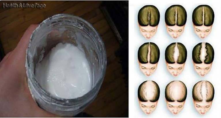 Le bicarbonate de soude comme Shampooing: vos cheveux pousseront comme par magie!