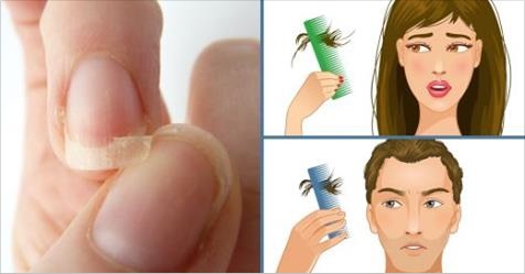 Si vous souffrez de troubles de sommeil, d’ongles cassants ou de chute de cheveux voici ce que vous devez faire