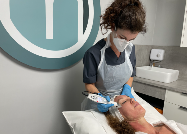 EPN Microneedling skin rejuvenation Lichfield Mode Laser Skin Clinic