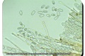 Mortagnebos-11-01-2023-Compostborstelbekertje-Microscopie-Marc-Rouzere